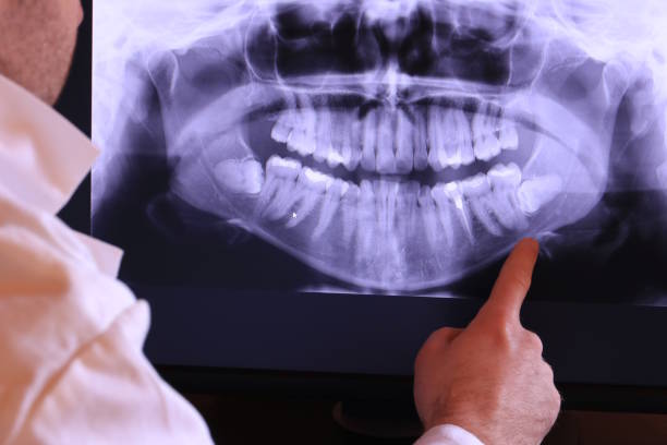 Emergency Dentist for Kids in OK